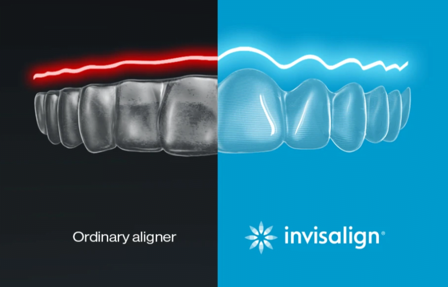 Invisalign