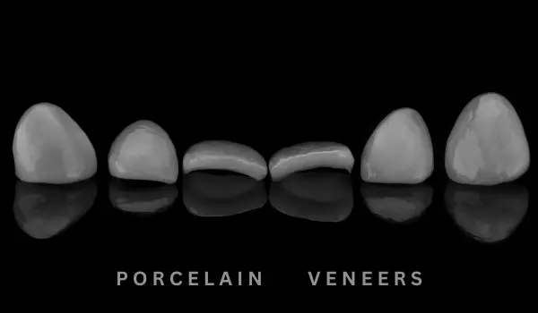 Porcelain Veneers