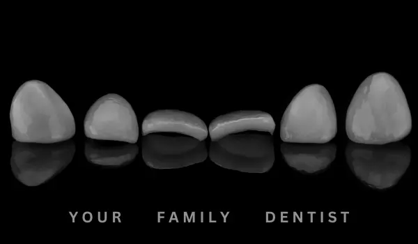 Dental Veneers