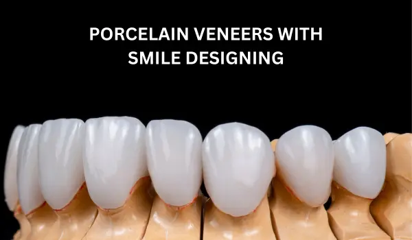 porcelain teeth veneers