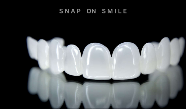 Snap-On Smile