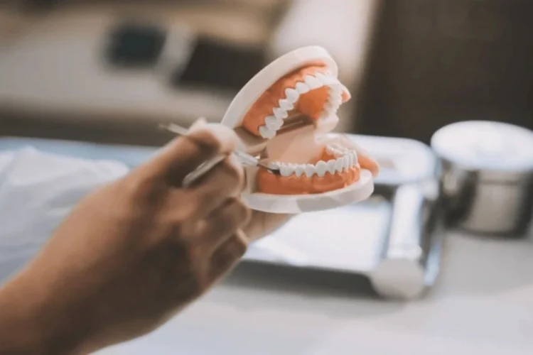 Illustration of implant supported denture vs traditional denture highlighting key differences in stability and fit.