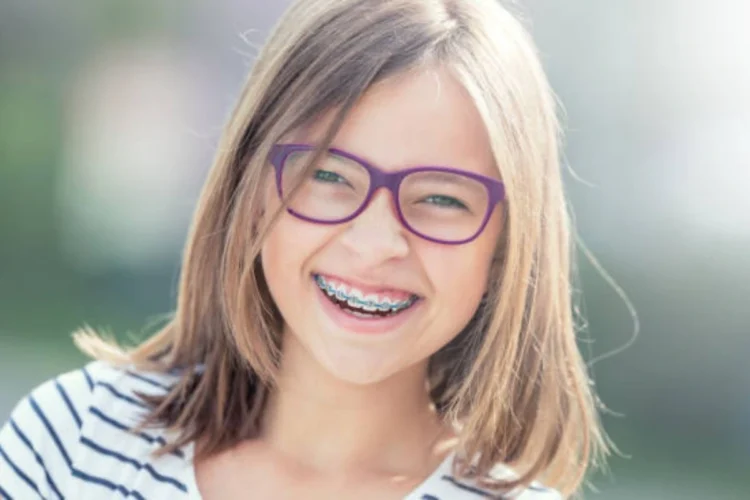 Traditional Braces for Children: Benefits, Process, and Care Tips 17 detailed guide on traditional braces for children, covering benefits, process, and care tips